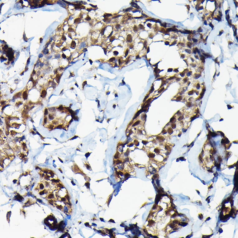 Immunohistochemistry - Anti-SUFU Antibody (A90436) - Antibodies.com