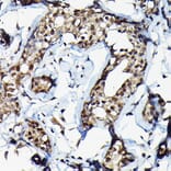 Immunohistochemistry - Anti-SUFU Antibody (A90436) - Antibodies.com