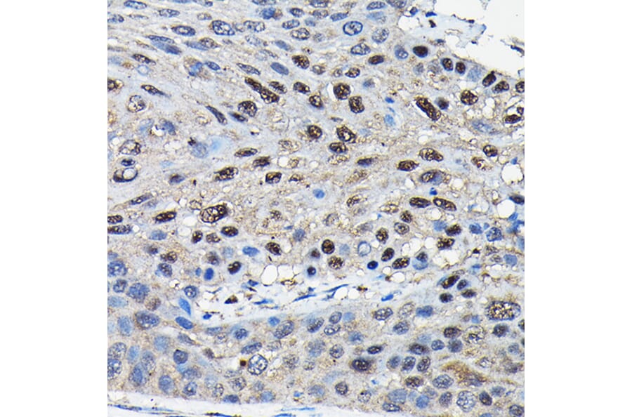 Immunohistochemistry - Anti-SUFU Antibody (A90436) - Antibodies.com