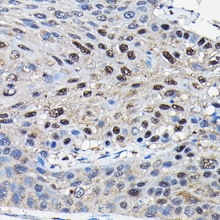 Immunohistochemistry - Anti-SUFU Antibody (A90436) - Antibodies.com