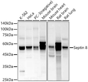 Western Blot - Anti-Septin 8 Antibody (A90437) - Antibodies.com