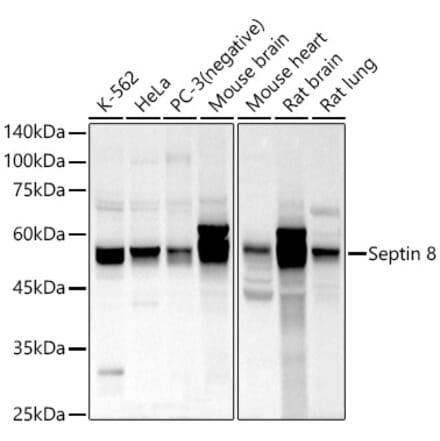 Western Blot - Anti-Septin 8 Antibody (A90437) - Antibodies.com