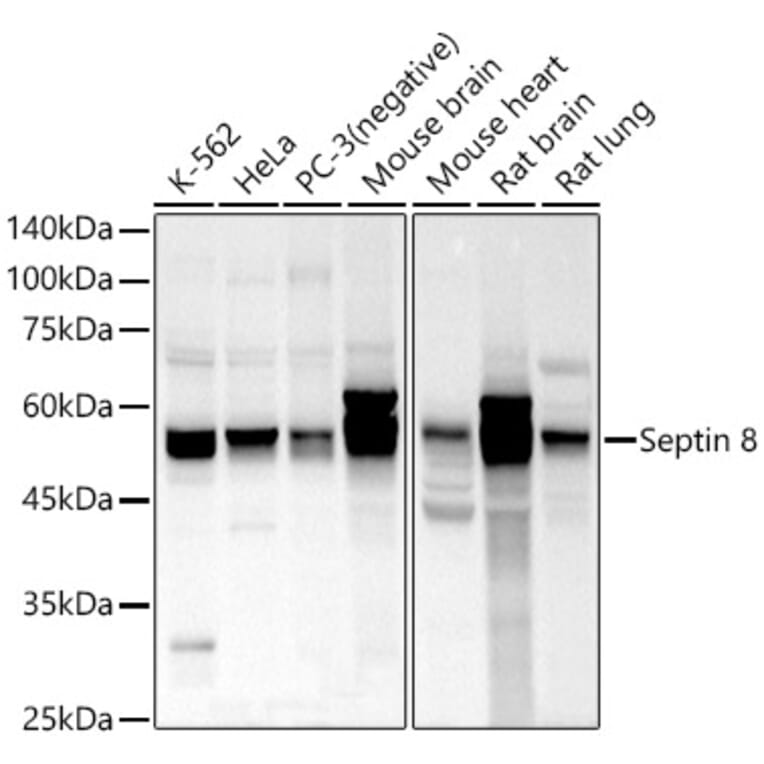 Western Blot - Anti-Septin 8 Antibody (A90437) - Antibodies.com
