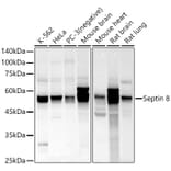 Western Blot - Anti-Septin 8 Antibody (A90437) - Antibodies.com