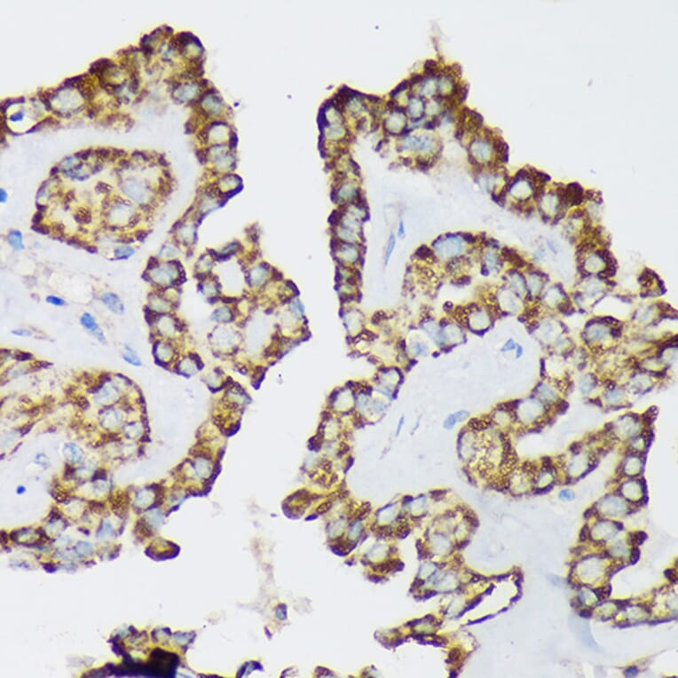 Immunohistochemistry - Anti-Septin 8 Antibody (A90437) - Antibodies.com
