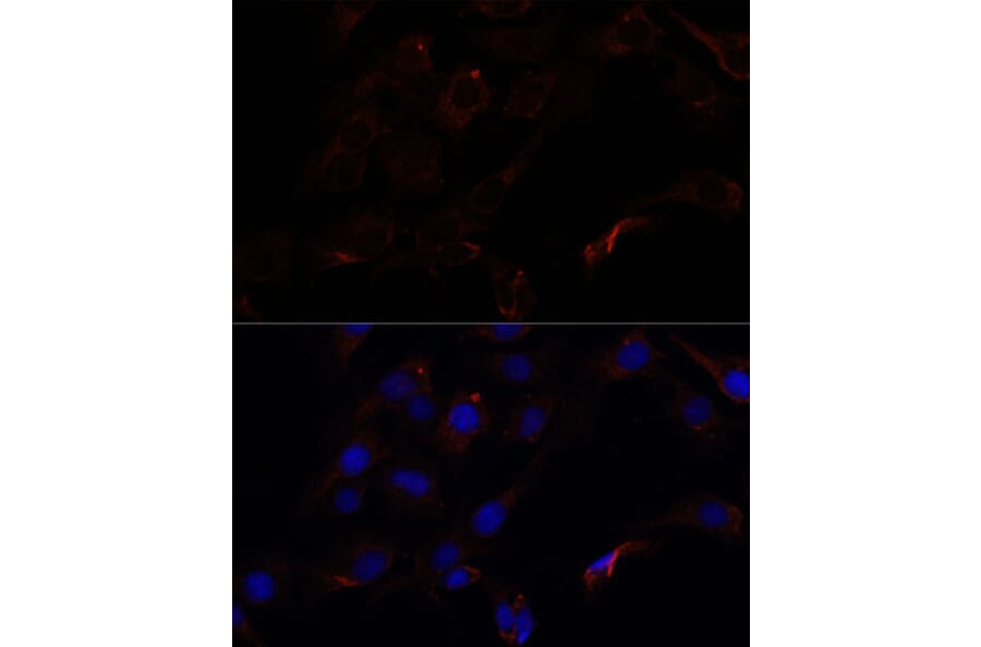 Immunofluorescence - Anti-Septin 8 Antibody (A90437) - Antibodies.com