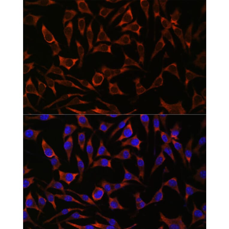 Immunofluorescence - Anti-Septin 8 Antibody (A90437) - Antibodies.com