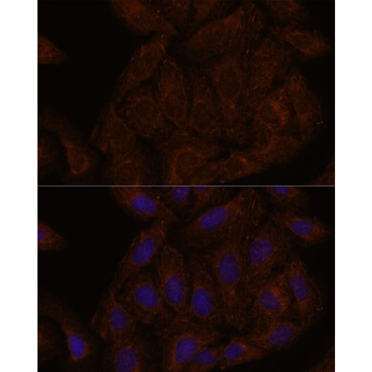 Immunofluorescence - Anti-Septin 8 Antibody (A90437) - Antibodies.com