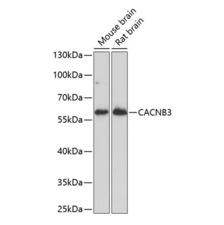 Western Blot - Anti-CAB3 Antibody (A90438) - Antibodies.com