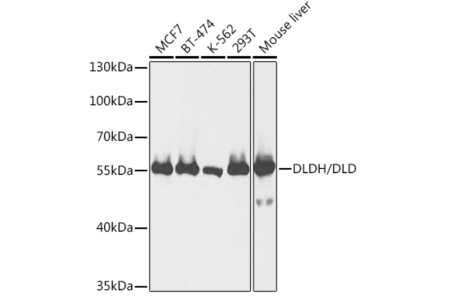 Western Blot - Anti-Lipoamide Dehydrogenase Antibody (A90439) - Antibodies.com