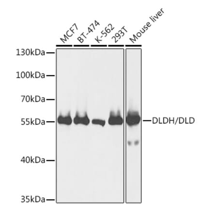 Western Blot - Anti-Lipoamide Dehydrogenase Antibody (A90439) - Antibodies.com