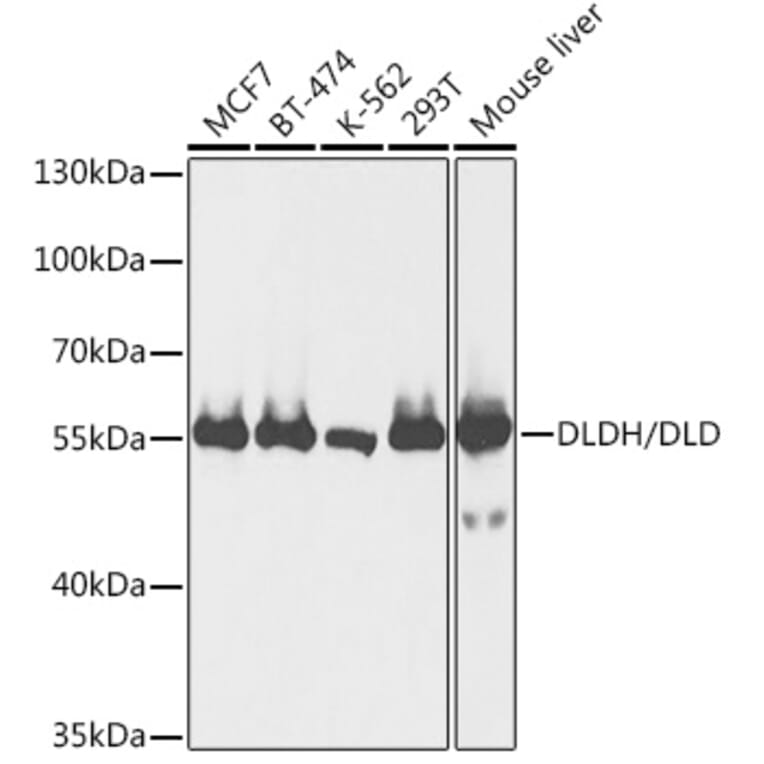 Western Blot - Anti-Lipoamide Dehydrogenase Antibody (A90439) - Antibodies.com