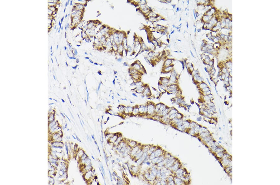 Immunohistochemistry - Anti-Lipoamide Dehydrogenase Antibody (A90439) - Antibodies.com