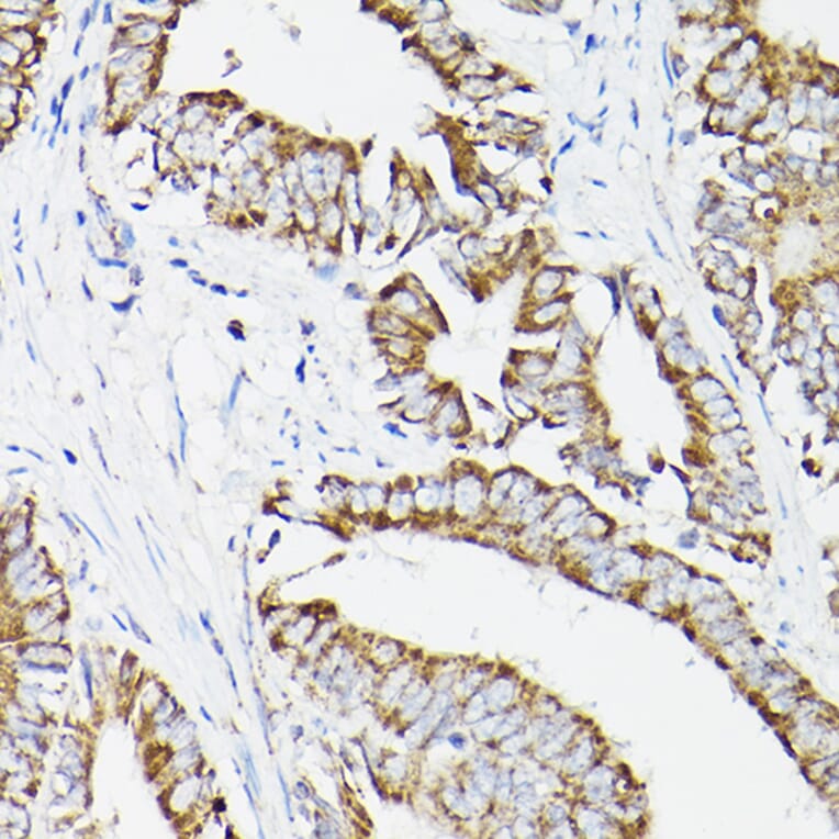 Immunohistochemistry - Anti-Lipoamide Dehydrogenase Antibody (A90439) - Antibodies.com