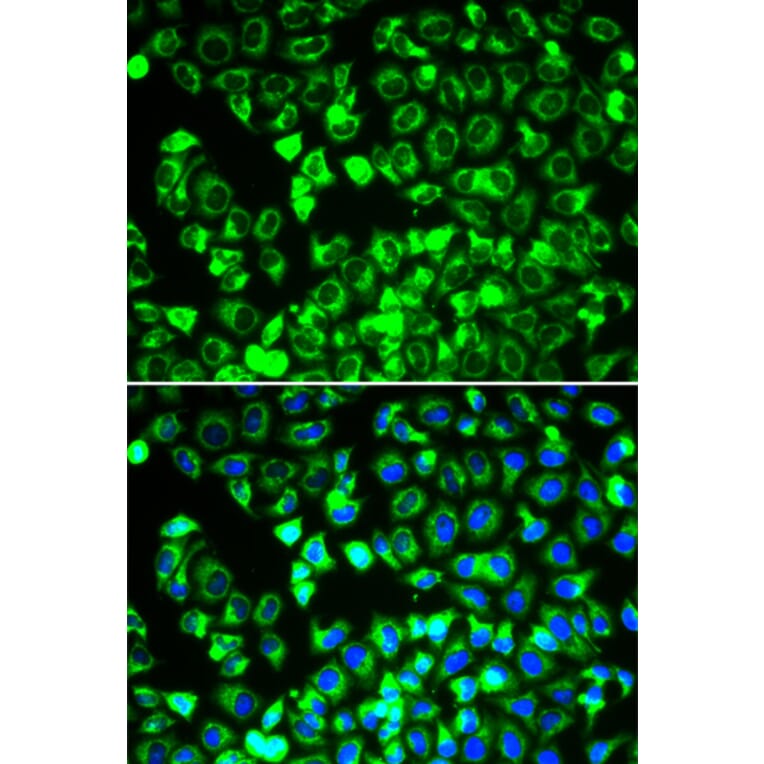 Immunofluorescence - Anti-Lipoamide Dehydrogenase Antibody (A90439) - Antibodies.com