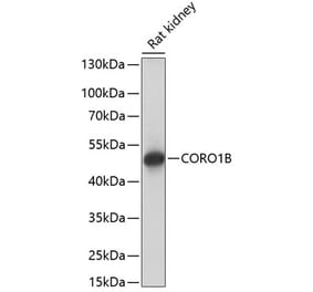 Western Blot - Anti-CORO1B Antibody (A90440) - Antibodies.com