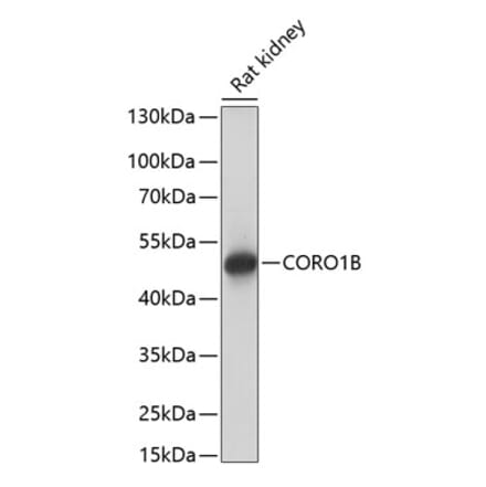 Western Blot - Anti-CORO1B Antibody (A90440) - Antibodies.com