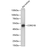 Western Blot - Anti-CORO1B Antibody (A90440) - Antibodies.com