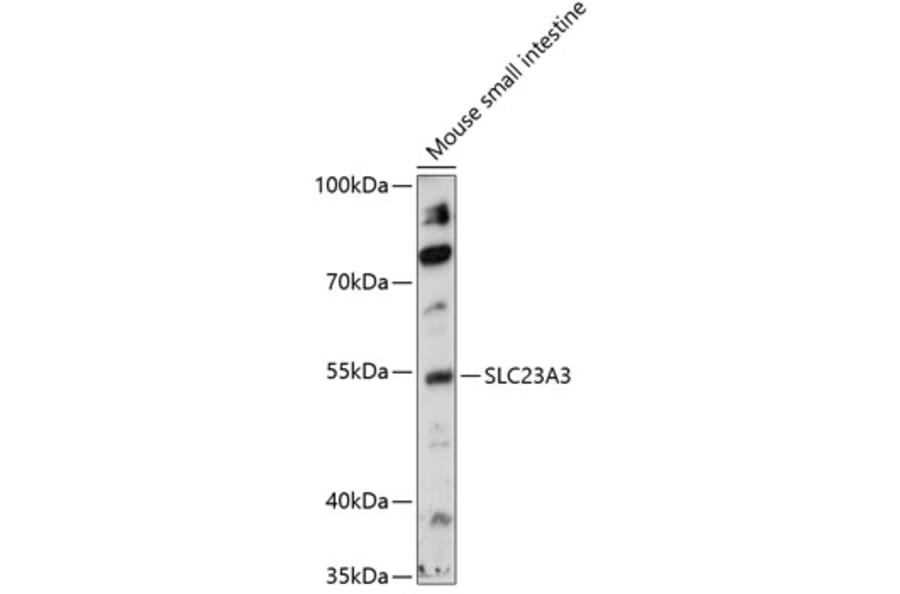 Western Blot - Anti-SLC23A3 Antibody (A90441) - Antibodies.com