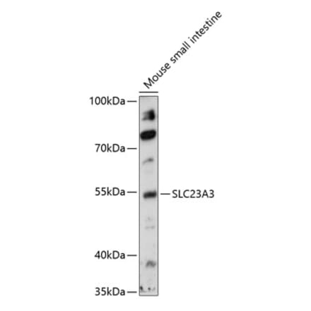 Western Blot - Anti-SLC23A3 Antibody (A90441) - Antibodies.com