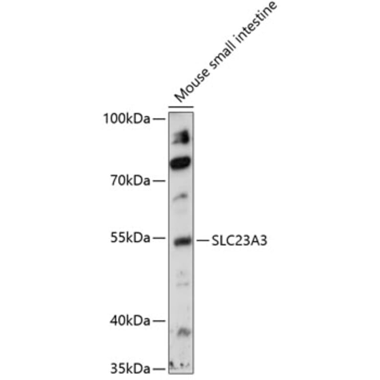 Western Blot - Anti-SLC23A3 Antibody (A90441) - Antibodies.com
