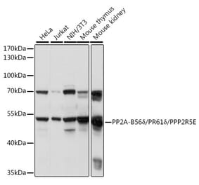 Western Blot - Anti-PPP2R5E Antibody (A90442) - Antibodies.com