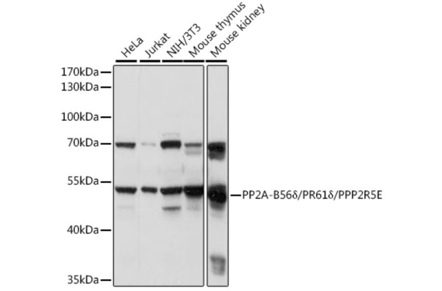 Western Blot - Anti-PPP2R5E Antibody (A90442) - Antibodies.com