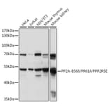 Western Blot - Anti-PPP2R5E Antibody (A90442) - Antibodies.com