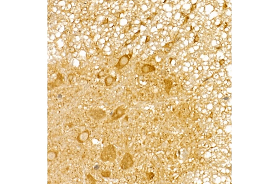 Immunohistochemistry - Anti-TRIM21/SS-A Antibody (A90443) - Antibodies.com