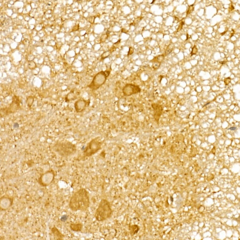 Immunohistochemistry - Anti-TRIM21/SS-A Antibody (A90443) - Antibodies.com
