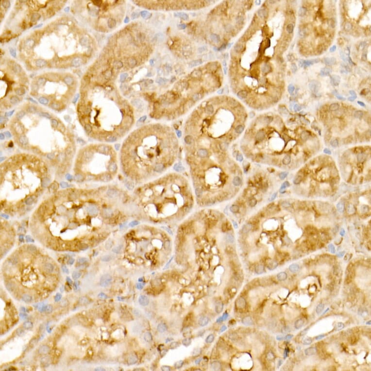 Immunohistochemistry - Anti-TRIM21/SS-A Antibody (A90443) - Antibodies.com