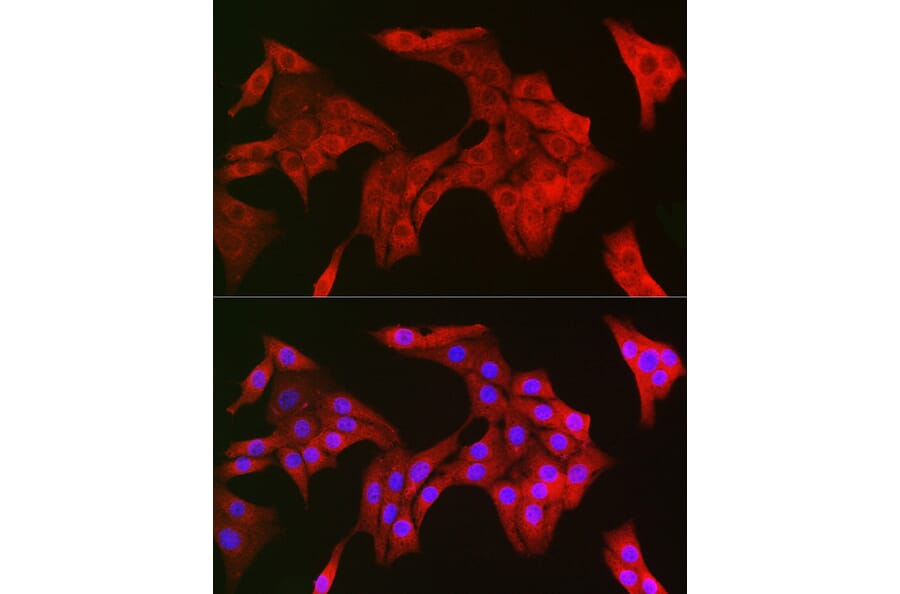 Immunofluorescence - Anti-TRIM21/SS-A Antibody (A90443) - Antibodies.com