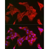 Immunofluorescence - Anti-TRIM21/SS-A Antibody (A90443) - Antibodies.com