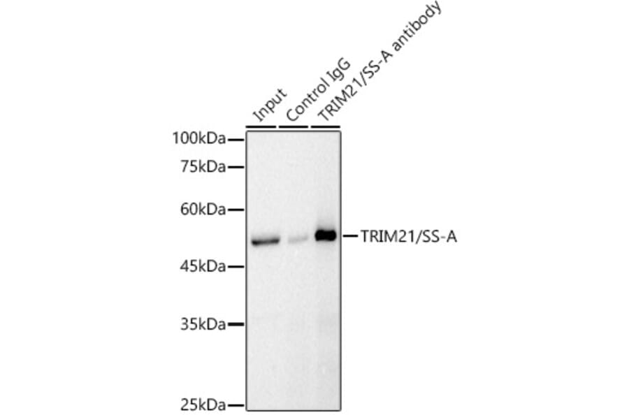 Western Blot - Anti-TRIM21/SS-A Antibody (A90443) - Antibodies.com