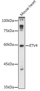 Western blot analysis of extracts of various cell lines, using Anti-ETV4 Antibody (A13860) at 1:3000 dilution.
Secondary antibody: Goat Anti-Rabbit IgG (H+L) (HRP) (AS014) at 1:10,000 dilution.
Lysates / proteins: 25µg per lane.
Blocking buffer: 3% non-fat dry milk in TBST.
Detection: ECL Enhanced Kit (RM00021).
Exposure time: 90s.