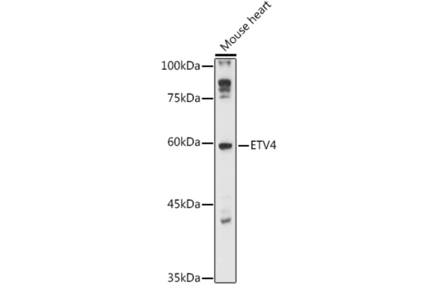 Western Blot - Anti-Pea3 Antibody (A90444) - Antibodies.com
