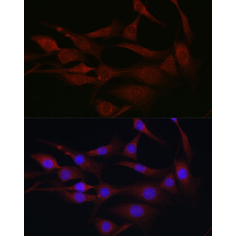 Immunofluorescence - Anti-MLKL Antibody (A90445) - Antibodies.com