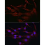 Immunofluorescence - Anti-MLKL Antibody (A90445) - Antibodies.com