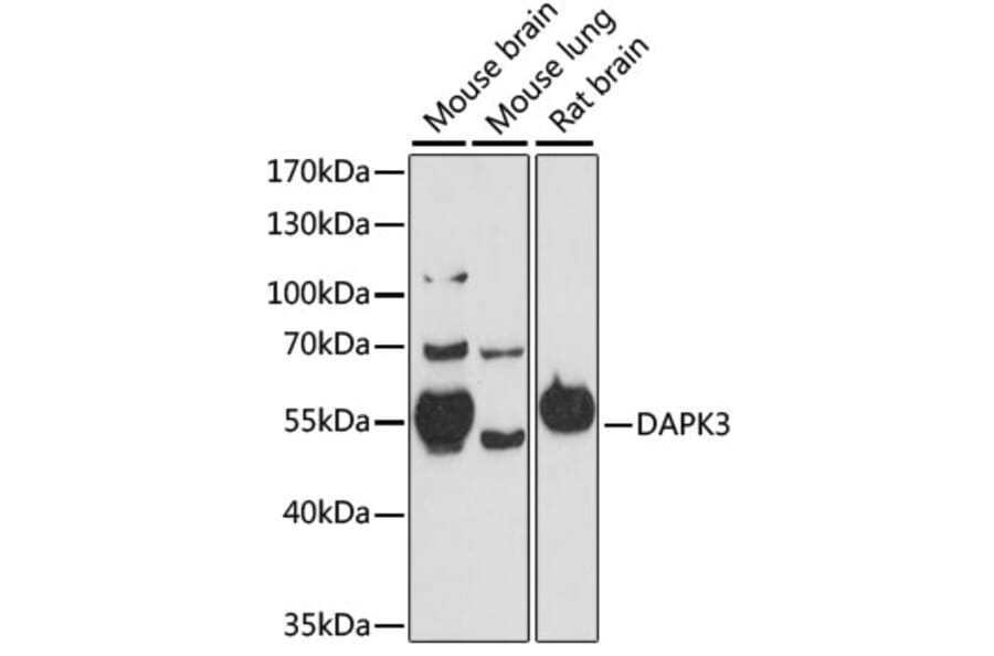 Western Blot - Anti-ZIP Kinase Antibody (A90446) - Antibodies.com
