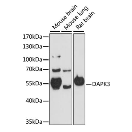 Western Blot - Anti-ZIP Kinase Antibody (A90446) - Antibodies.com