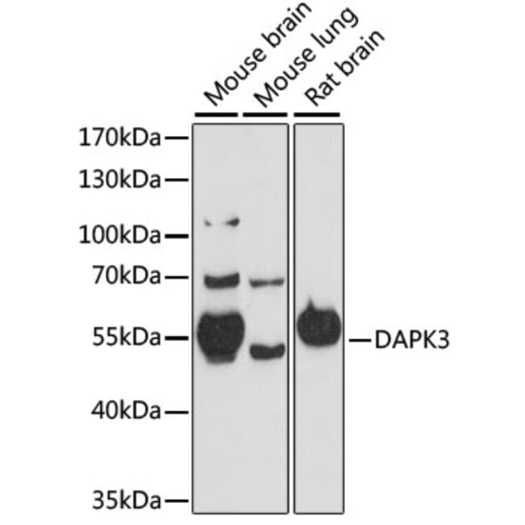 Western Blot - Anti-ZIP Kinase Antibody (A90446) - Antibodies.com