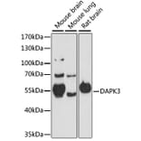 Western Blot - Anti-ZIP Kinase Antibody (A90446) - Antibodies.com