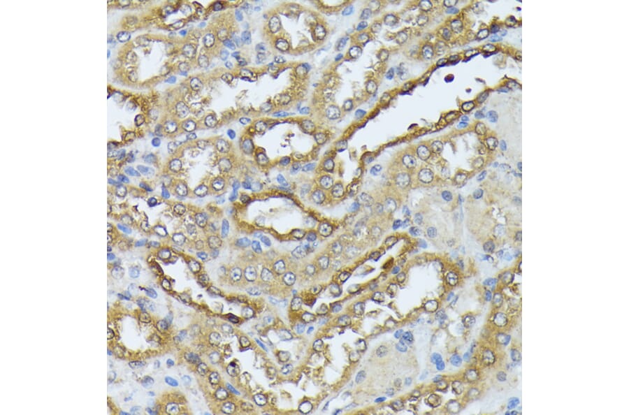 Immunohistochemistry - Anti-ZIP Kinase Antibody (A90446) - Antibodies.com