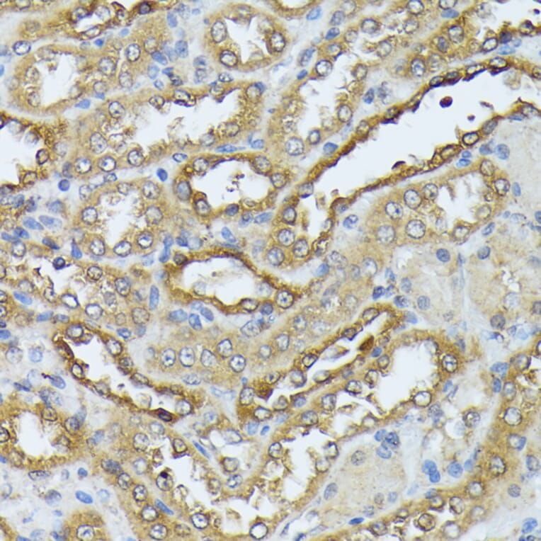 Immunohistochemistry - Anti-ZIP Kinase Antibody (A90446) - Antibodies.com
