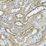Immunohistochemistry - Anti-ZIP Kinase Antibody (A90446) - Antibodies.com