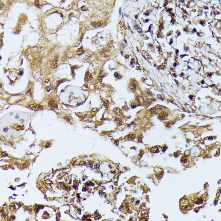 Immunohistochemistry - Anti-ZIP Kinase Antibody (A90446) - Antibodies.com