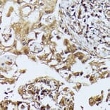 Immunohistochemistry - Anti-ZIP Kinase Antibody (A90446) - Antibodies.com