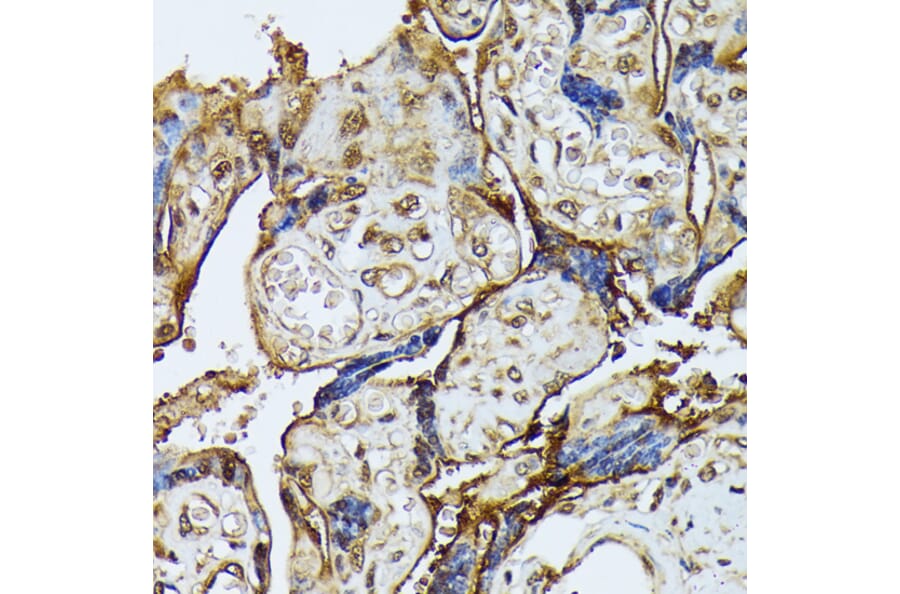 Immunohistochemistry - Anti-ZIP Kinase Antibody (A90446) - Antibodies.com