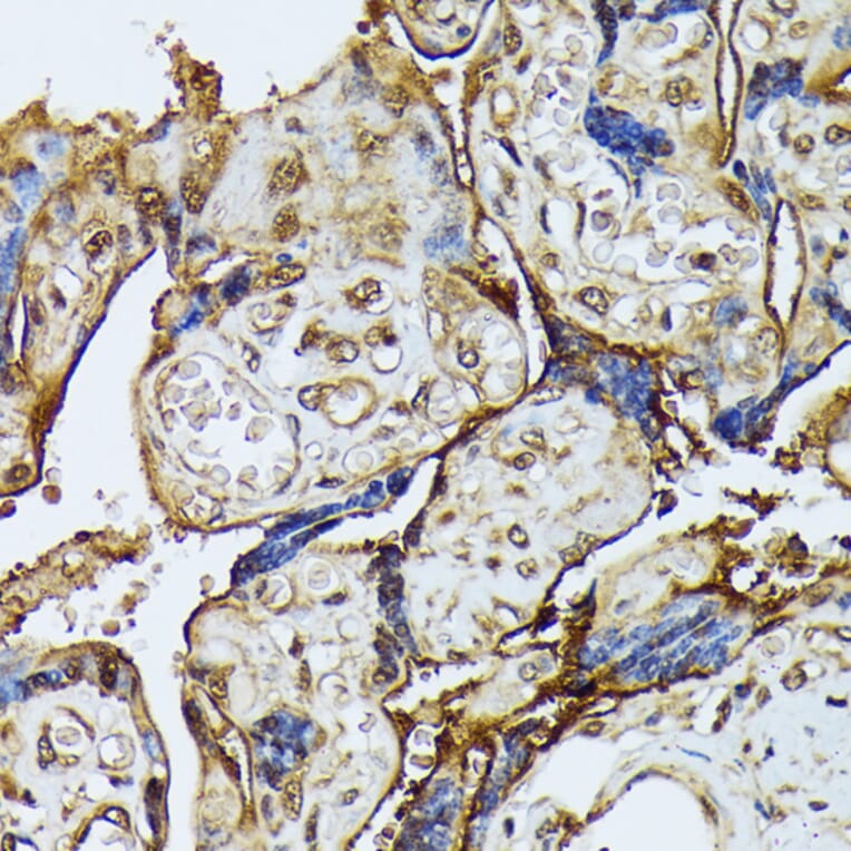 Immunohistochemistry - Anti-ZIP Kinase Antibody (A90446) - Antibodies.com