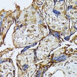 Immunohistochemistry - Anti-ZIP Kinase Antibody (A90446) - Antibodies.com